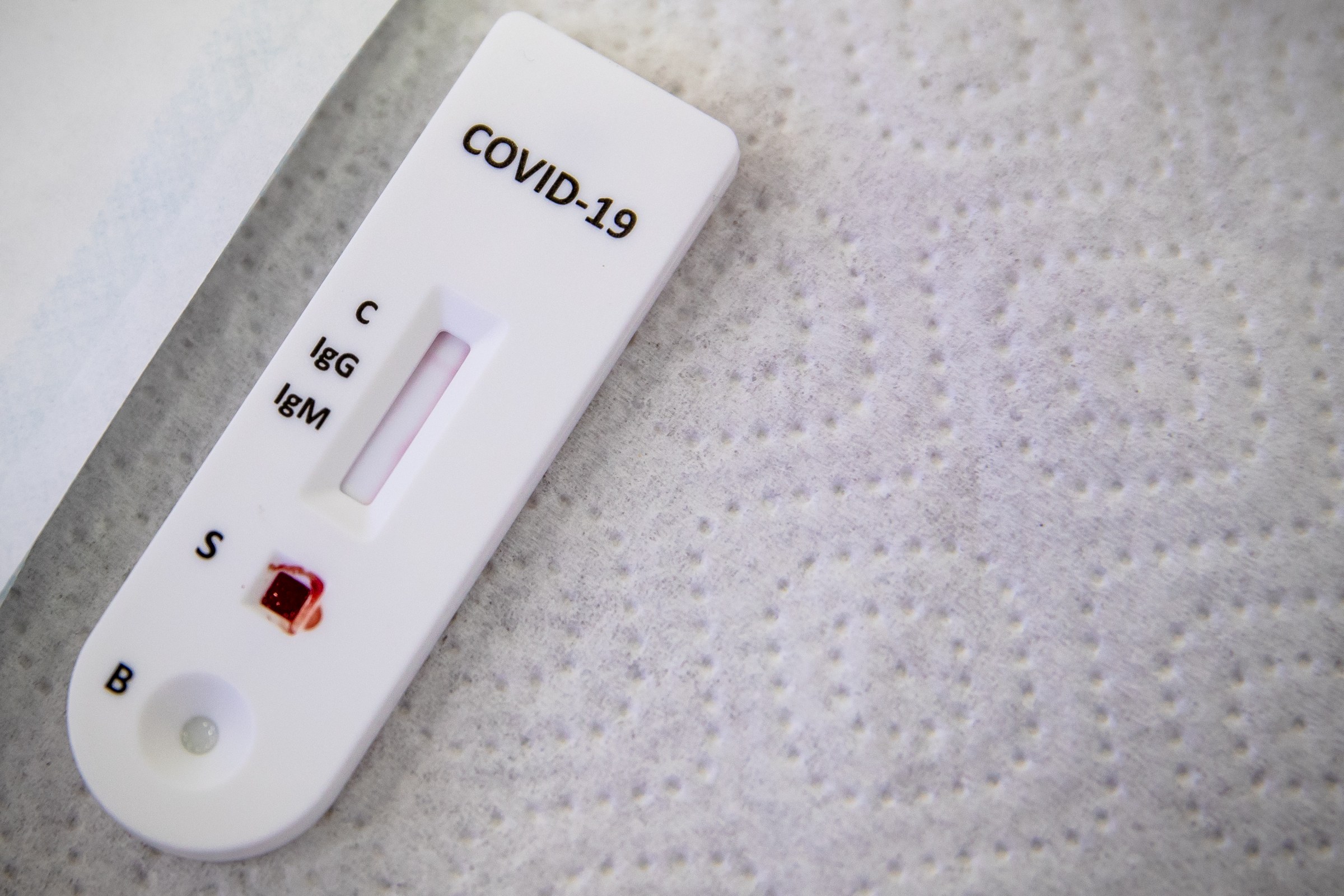 US govt announces $600 mn in Covid tests manufacture - Vimarsana News