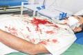 Unidentified persons attack on APNGO&#039;s - Sakshi Post