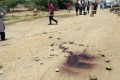 2-year-old dead as bus runs over - Sakshi Post