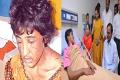 Telangana CM sanctions Rs.5 lakh for torture victim - Sakshi Post