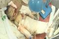 Rats feast on new-born Rats feast on new-born - Sakshi Post