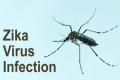 Why Zika infection may lead to severe joint condition at birth - Sakshi Post