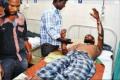 A injured victim undergoing treatment&amp;amp;nbsp; - Sakshi Post