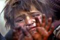 Representative image - Sakshi Post