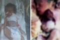 Baby Laraib has been diagnosed with Ectopia Cardis - Sakshi Post