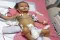 Shirjay is currently admitted in ICU due to acute metabolic acidosis and the connected ailments Shirjay is currently admitted in ICU due to acute metabolic acidosis and the connected ailments - Sakshi Post