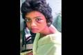 The girl with an injury under her left eye after her mother beat her up - Sakshi Post