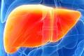 Western food could harm liver more ..... - Sakshi Post