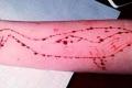 Blue whale drawn on the forearm of a girl - Sakshi Post