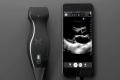 device called Butterfly IQ is a scanner of the size of an electric razor that can display black-and-white imagery of the body, when paired with an iPhone - Sakshi Post