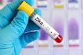 Zika virus test during pregnancy - Sakshi Post