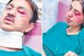 A journalist and his wife were brutally beaten up by a band of robbers at Kerala. - Sakshi Post