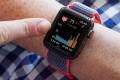 Apple Watch - Sakshi Post