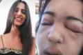 Brazil Girl dies from deadly infection after piercing her own eyebrow at home - Sakshi Post