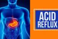All You Need To Know About Acid Reflux - Sakshi Post