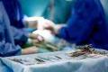 Doctors Remove 156 Kidney Stones from Single Patient in Hyderabad - Sakshi Post