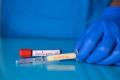 Covid Vaccine Need to be Updated for Continued Protection - Sakshi Post