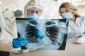 AI Based X Rays to Predict Covid Infections With 98pc Accuracy - Sakshi Post