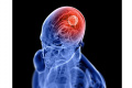 World Tumor Day - Sakshi Post