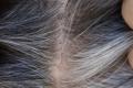  US scientists decode why our hairs turn grey  - Sakshi Post