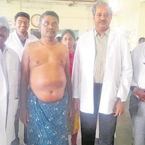 Doctors in Guntur Government General Hospital (GGH) identified and removed a rare tumor from  a patient' stomach Guntur: Rare Tumor Removed Free Of Cost Under YSR ArogyaSri - Vimarsana News