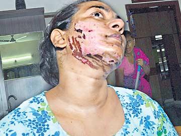 Laser treatment fails, doctors arrested - Sakshi Post