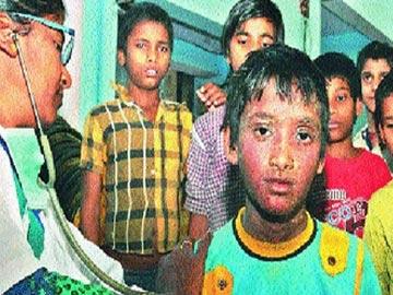 1397 kids rescued in Telangana under &#039;operation smile&#039; - Sakshi Post