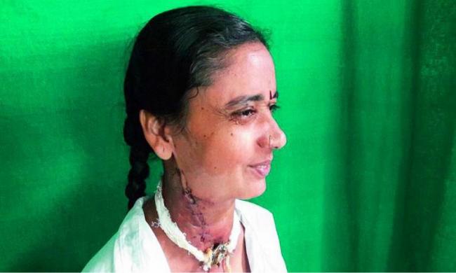 Latha hailing from Nizamabad was diagnosed with laryngeal cancer in 2011 Latha hailing from Nizamabad was diagnosed with laryngeal cancer in 2011 - Sakshi Post