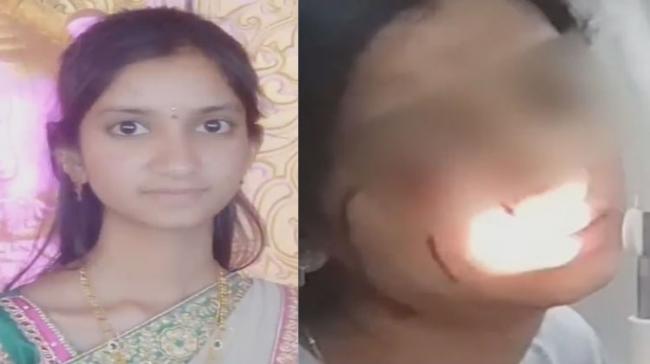 Swapna undergoing treatment at Sarojini Devi Eye Hospital - Sakshi Post