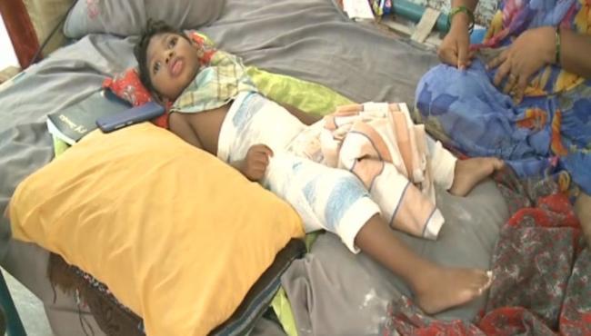 The child whose leg was broken during treatment at govt hospital - Sakshi Post