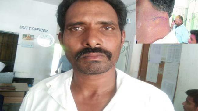 A TRS leader was attacked by a man suspecting an extramarital relationship - Sakshi Post
