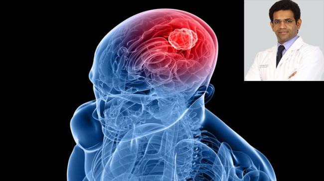 Love In Times Of Brain Tumour: Riding The Emotional Roller-coaster Love In Times Of Brain Tumour: Riding The Emotional Roller-coaster - Sakshi Post