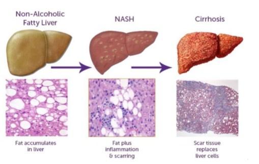 Liver - Sakshi Post