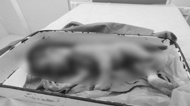 Hindupur Woman Abandons Dead Baby Inside Govt Hospital Toilet Hindupur Woman Abandons Dead Baby Inside Govt Hospital Toilet - Sakshi Post