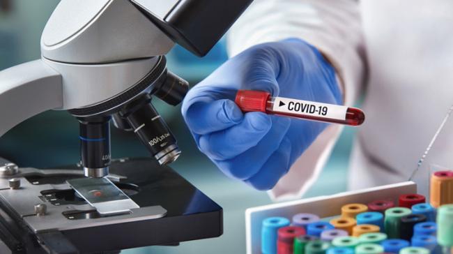 Andhra Pradesh conducts over 4 lakh coronavirus tests - Sakshi Post