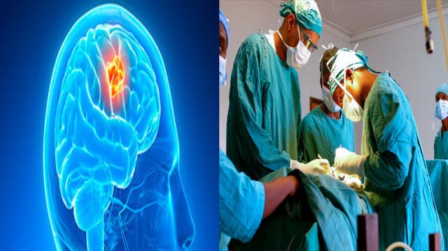 Representational Image - Sakshi Post