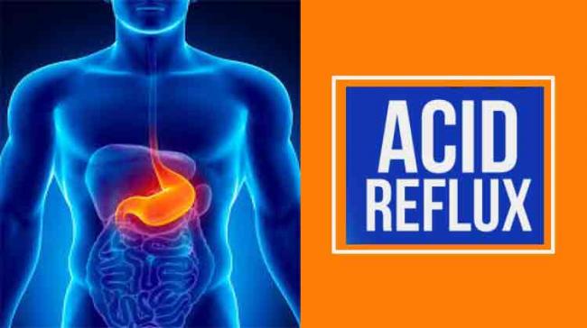 All You Need To Know About Acid Reflux - Sakshi Post