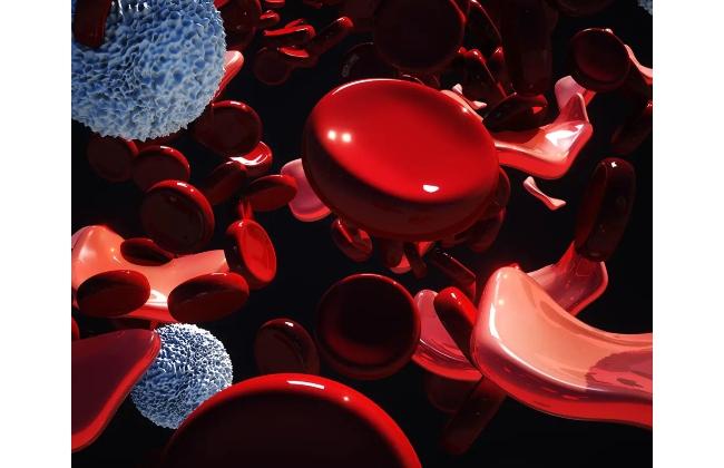 Image Source: Google Thalessemia - Sakshi Post