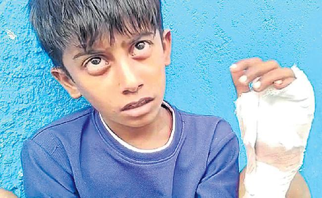  Telangana: Stray Dogs Menace Continues, 21 People Bitten In Jangaon - Sakshi Post